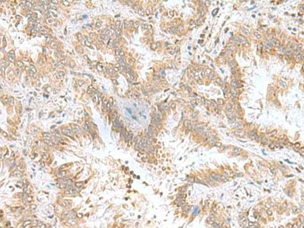 Anti-Human/Mouse CPLX3 Antibody