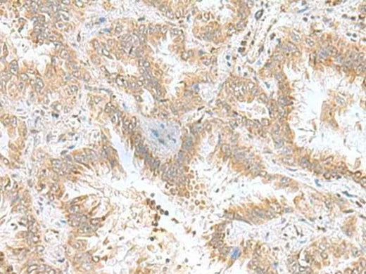 Anti-Human/Mouse CPLX3 Antibody