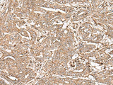 Anti-Human/Mouse FAAP24 Antibody - ABMIUM
