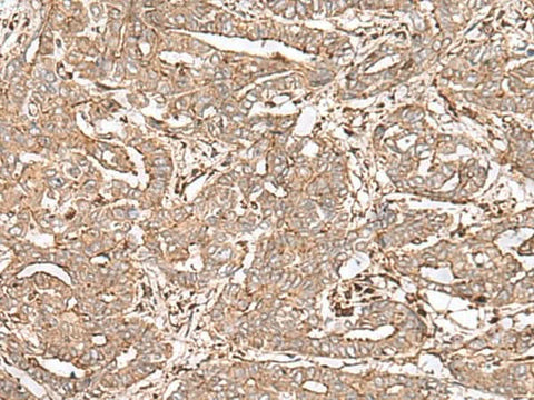 Anti-Human/Mouse FAAP24 Antibody - ABMIUM