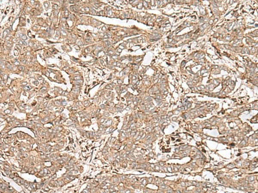 Anti-Human/Mouse FAAP24 Antibody - ABMIUM
