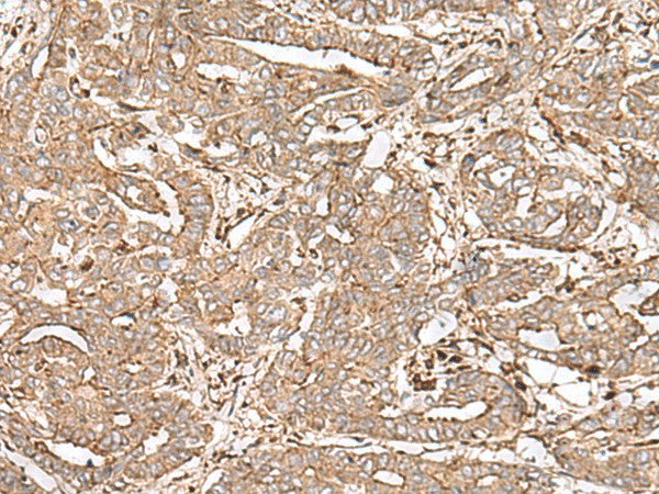 Anti-Human/Mouse FAAP24 Antibody - ABMIUM