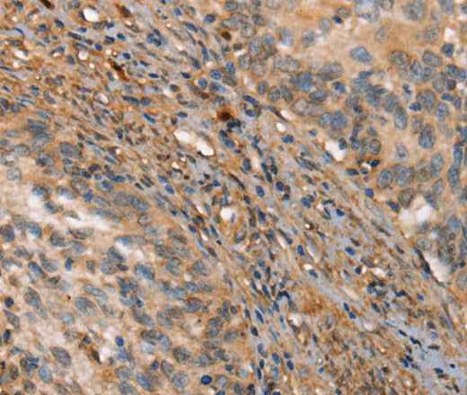 Anti-Human/Mouse/Rat HK3 Antibody