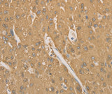 Anti-Human/Mouse CD40 Antibody - ABMIUM