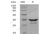 Recombinant Human Desmin Protein (His Tag) - ABMIUM