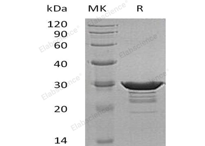 Recombinant Human Desmin Protein (His Tag) - ABMIUM