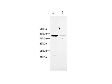 Anti-Human/Rat IL-17C Antibody - ABMIUM