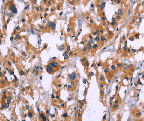 Anti-Human/Mouse ZEB2 Antibody - ABMIUM