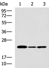 Anti-Human IL19 Antibody - ABMIUM