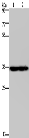 Anti-Human/Mouse NDUFA9 Antibody - ABMIUM