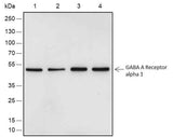 Anti-Human/Rat/Mouse GABA A Receptor alpha 1 Antibody [A523]