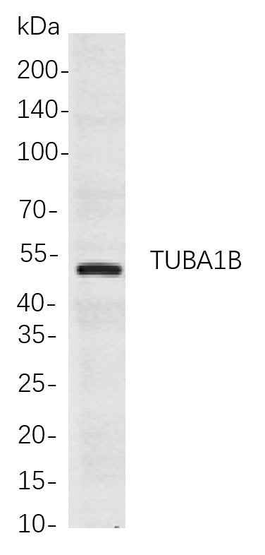 Anti-Human/Mouse/Rat TUBA1B Antibody [B717] - ABMIUM
