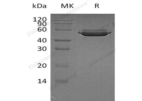 Recombinant Human Cathepsin A/CTSA Protein (His Tag) - ABMIUM