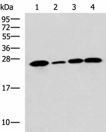 Western blot analysis of Human cerebrum tissue A172 cell Mouse brain tissue Rat brain tissue lysates using UCHL1 Polyclonal Antibody at dilution of 1:900