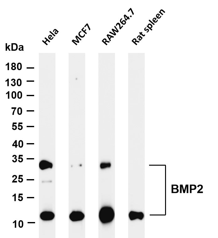 Anti-Human/Rat/Mouse BMP2 Antibody [A0362R] - ABMIUM
