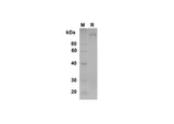 SDS-PAGE analysis of Human ICAM-5 proteins , 2 μg/lane of Recombinant Human ICAM-5 proteins was resolved with SDS-PAGE under reducing conditions , showing bands at 113 kDa.