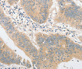 Anti-Human CD284 Antibody - ABMIUM