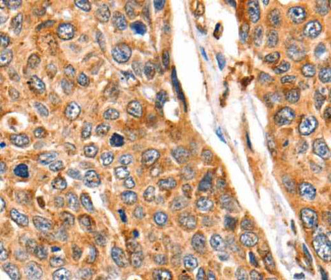 Anti-Human/Mouse/Rat CTSB Antibody
