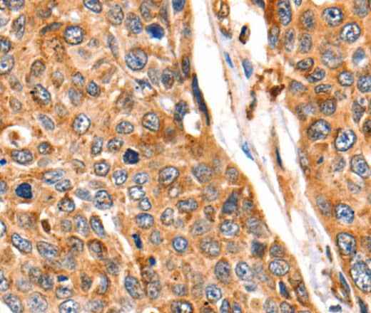 Anti-Human/Mouse/Rat CTSB Antibody