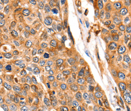 Anti-Human/Mouse/Rat CTSB Antibody - ABMIUM