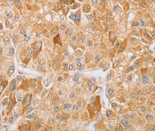 Anti-Human/Mouse/Rat NGF Antibody