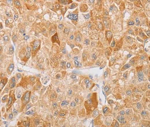 Anti-Human/Mouse/Rat NGF Antibody - ABMIUM