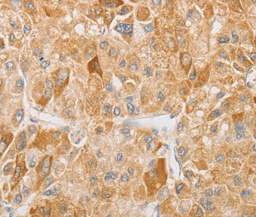 Anti-Human/Mouse/Rat NGF Antibody - ABMIUM