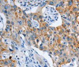 Anti-Human/Mouse/Rat ASL Antibody - ABMIUM