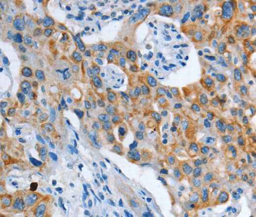 Anti-Human/Mouse/Rat ASL Antibody