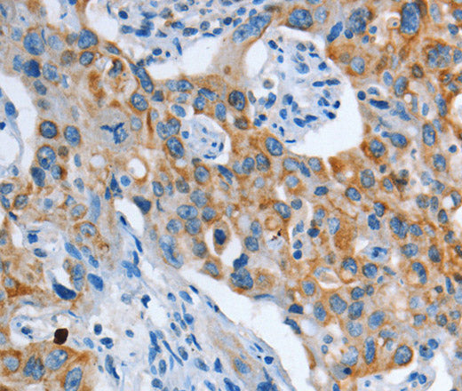 Anti-Human/Mouse/Rat ASL Antibody - ABMIUM