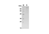 SDS-PAGE analysis of Human LDLR proteins, 2 μg/lane of Recombinant Human LDLR proteins was resolved with SDS-PAGE under reducing conditions, showing bands at 90-140 kDa.
