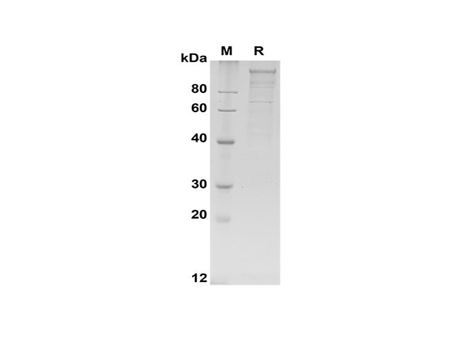 SDS-PAGE analysis of Human LDLR proteins, 2 μg/lane of Recombinant Human LDLR proteins was resolved with SDS-PAGE under reducing conditions, showing bands at 90-140 kDa.