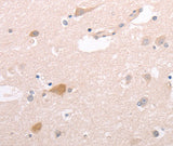 Anti-Human/Mouse CIDEB Antibody - ABMIUM
