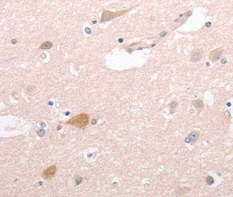 Anti-Human/Mouse CIDEB Antibody