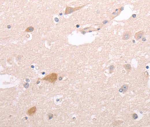 Anti-Human/Mouse CIDEB Antibody - ABMIUM