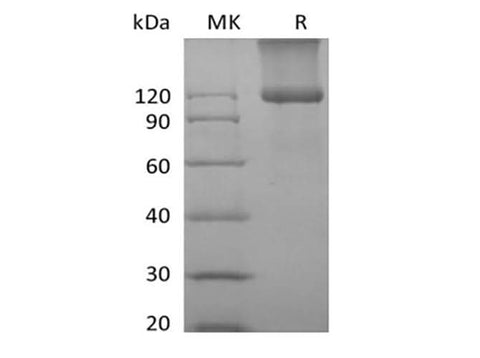 Recombinant Mouse TGFBR3 (C-6His) - ABMIUM