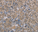 Anti-Human MGLL Antibody - ABMIUM