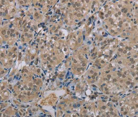 Anti-Human MGLL Antibody