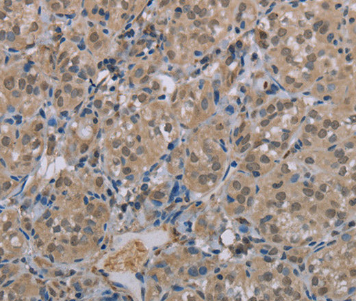Anti-Human MGLL Antibody - ABMIUM