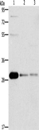 Anti-Human/Mouse/Rat BCL10 Antibody - ABMIUM