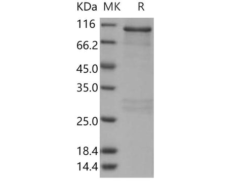 > 84 % as determined by reducing SDS-PAGE.
