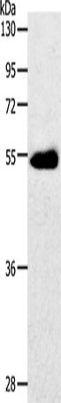 Anti-Human SLC2A3 Antibody - ABMIUM