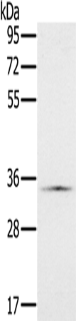 Anti-Human/Mouse NDUFA9 Antibody - ABMIUM