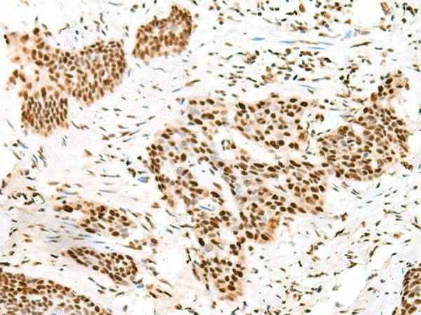 Anti-Human TCOF1 Antibody