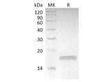 Recombinant Rabbit TNF-alpha/TNFSF2/TNFa Protein - ABMIUM