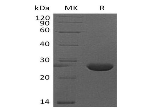 Recombinant Mouse FGF-9/FGF9 Protein (His Tag) - ABMIUM