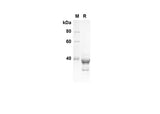 SDS-PAGE analysis of Human PRKAA1 proteins , 2 μg/lane of Recombinant Human PRKAA1 proteins was resolved with SDS-PAGE under reducing conditions , showing bands at 39 kDa.