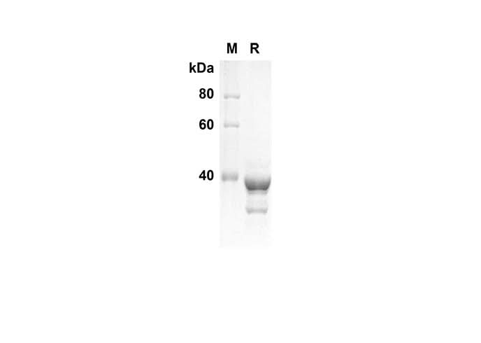 SDS-PAGE analysis of Human PRKAA1 proteins , 2 μg/lane of Recombinant Human PRKAA1 proteins was resolved with SDS-PAGE under reducing conditions , showing bands at 39 kDa.