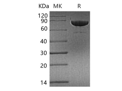 Recombinant Human Transferrin Receptor/TFRC Protein (His Tag) - ABMIUM
