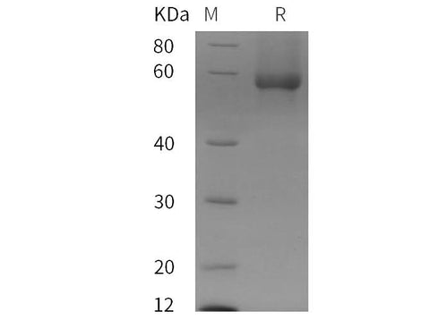 SDS-PAGE analysis of Human Glypican-1/GPC1 proteins, 2 μg/lane of Recombinant Human Glypican-1/GPC1 proteins was resolved with SDS-PAGE under reducing conditions, showing bands at 58 kDa.